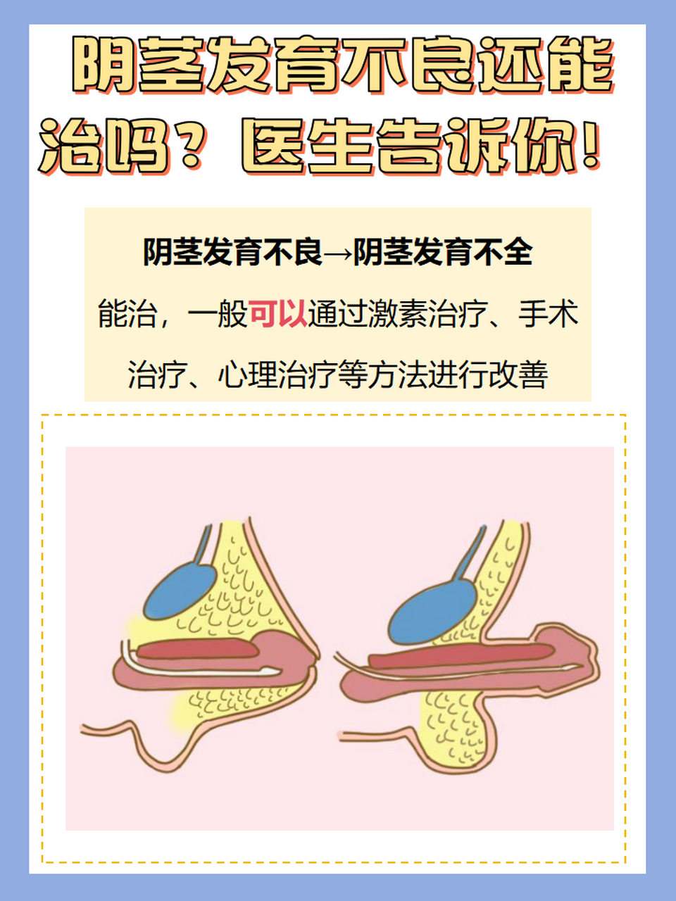 阴茎发育不良还能治吗?医生告诉你!