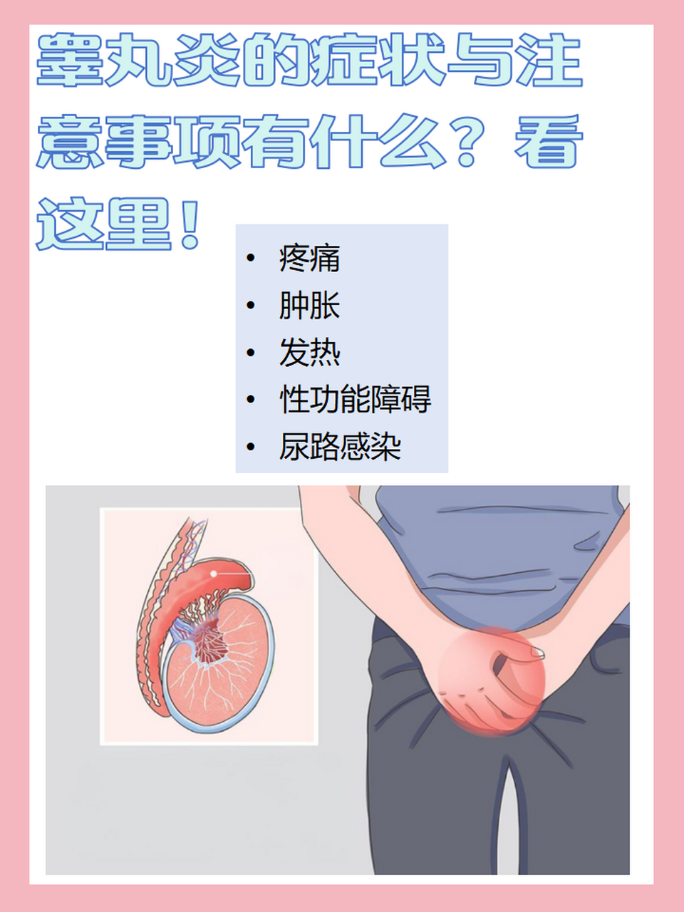 🌟睾丸炎,作为男性生殖系统常见的感染性疾病,其症状表现多种多样