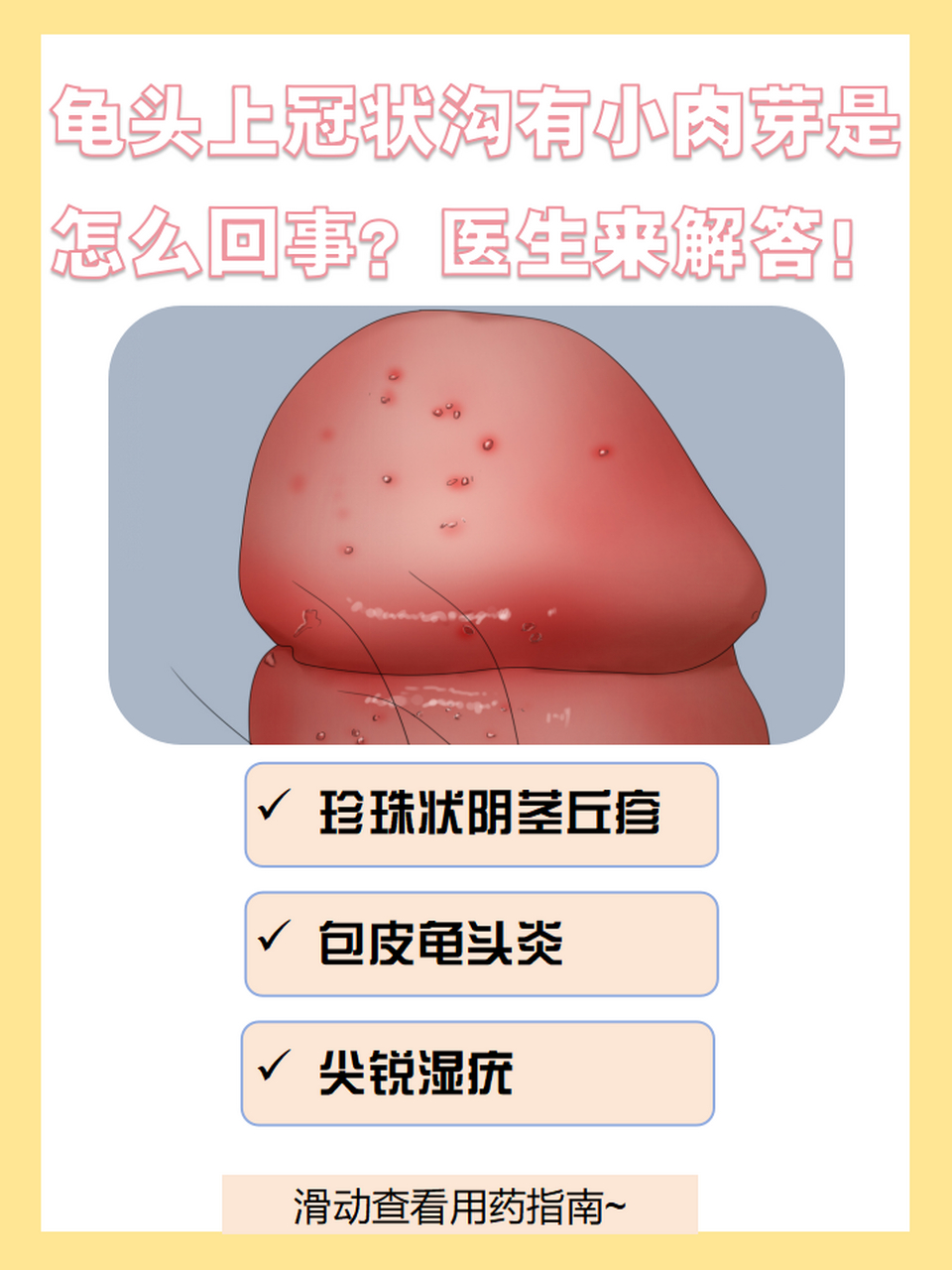 龟头上冠状沟有小肉芽是怎么回事?医生来解答!