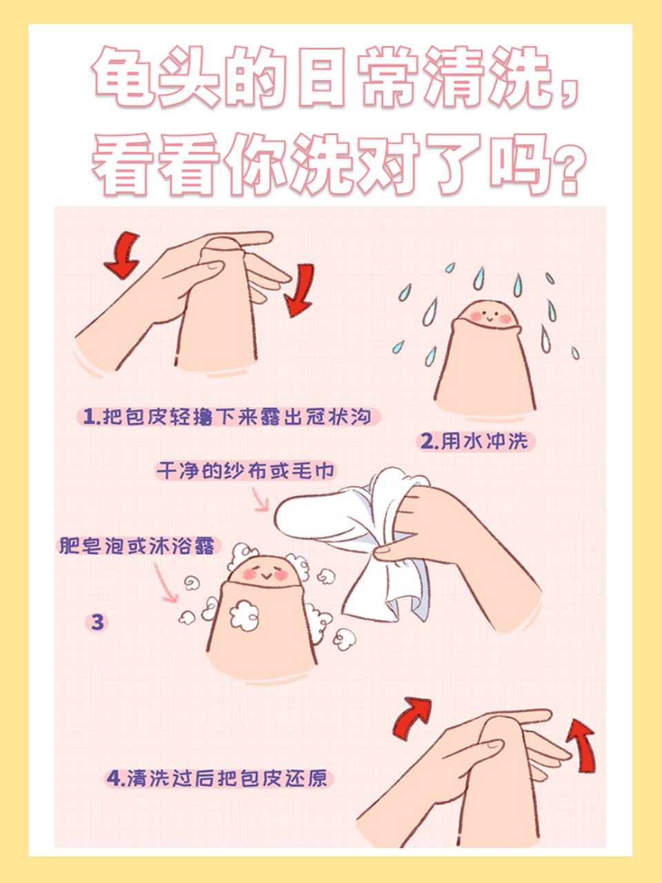 龟头上冠状沟有小肉芽是怎么回事?医生来解答!