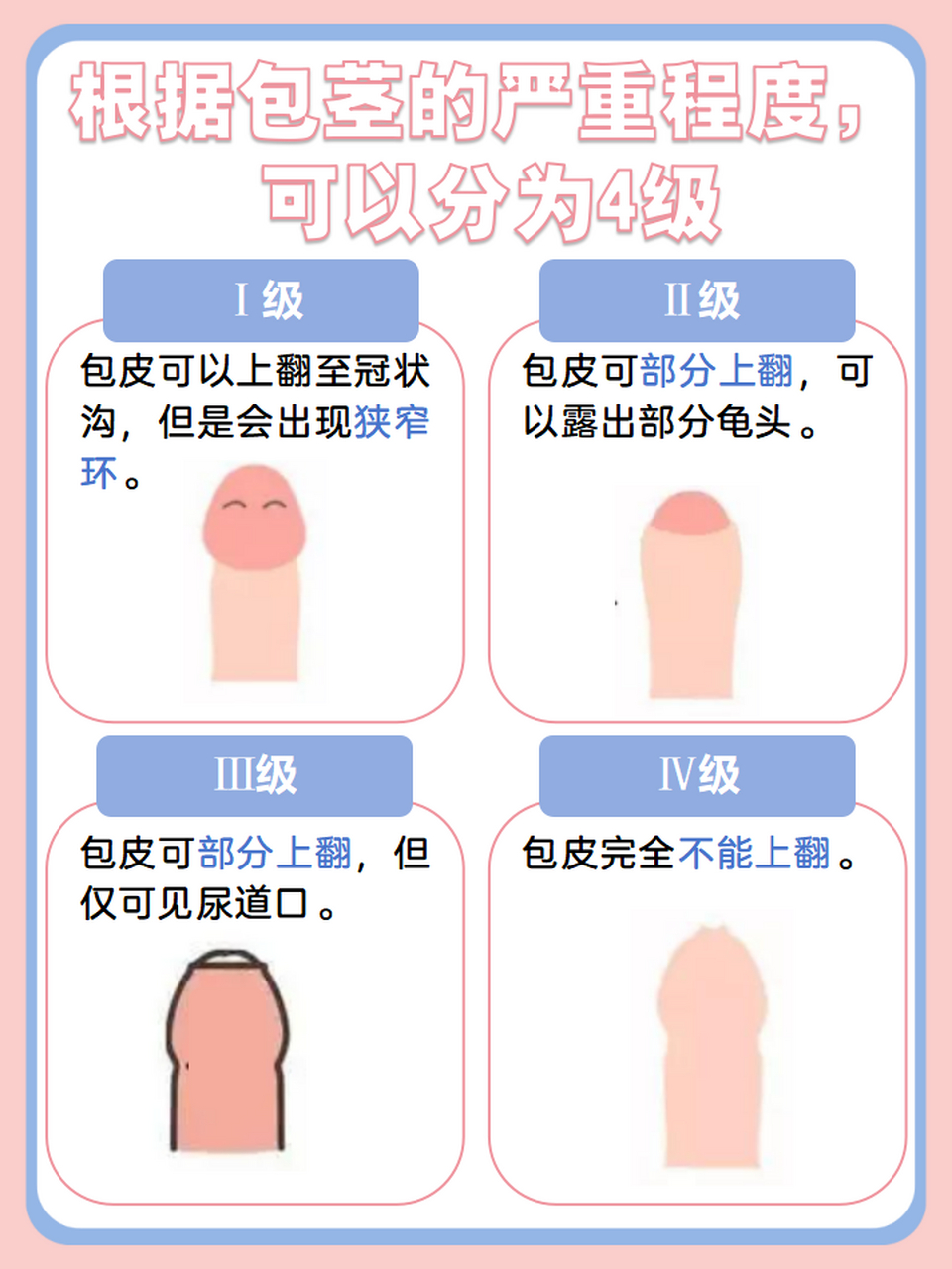 今日分享:男性出现包茎严重吗?