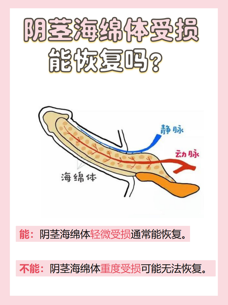 海绵体受损怎么恢复?图片