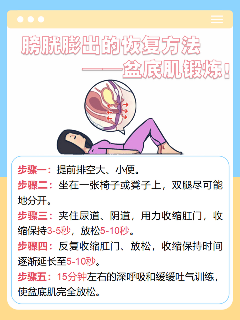 女性膀胱下垂图 下坠图片