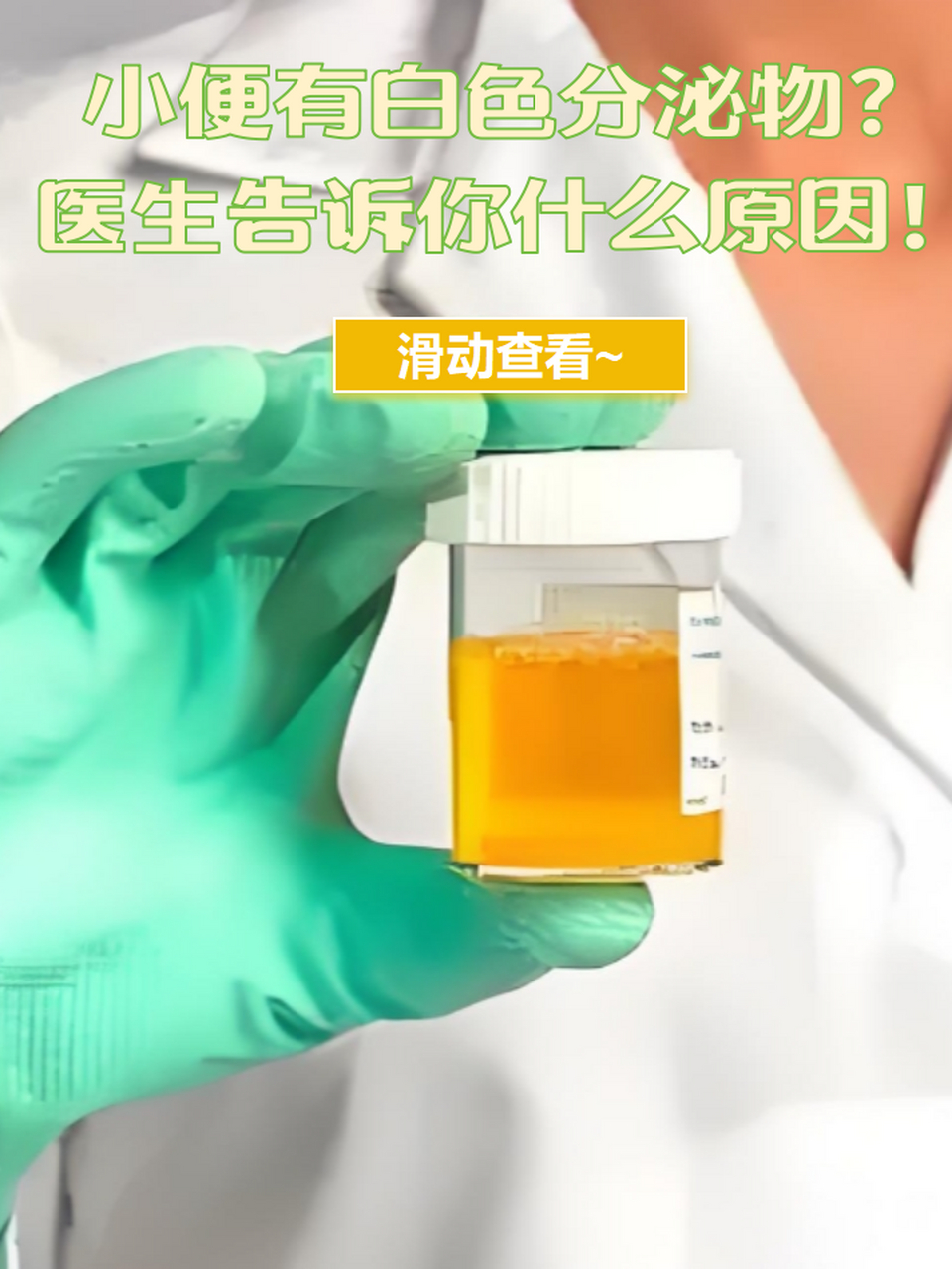 前列腺液颜色乳白色图片