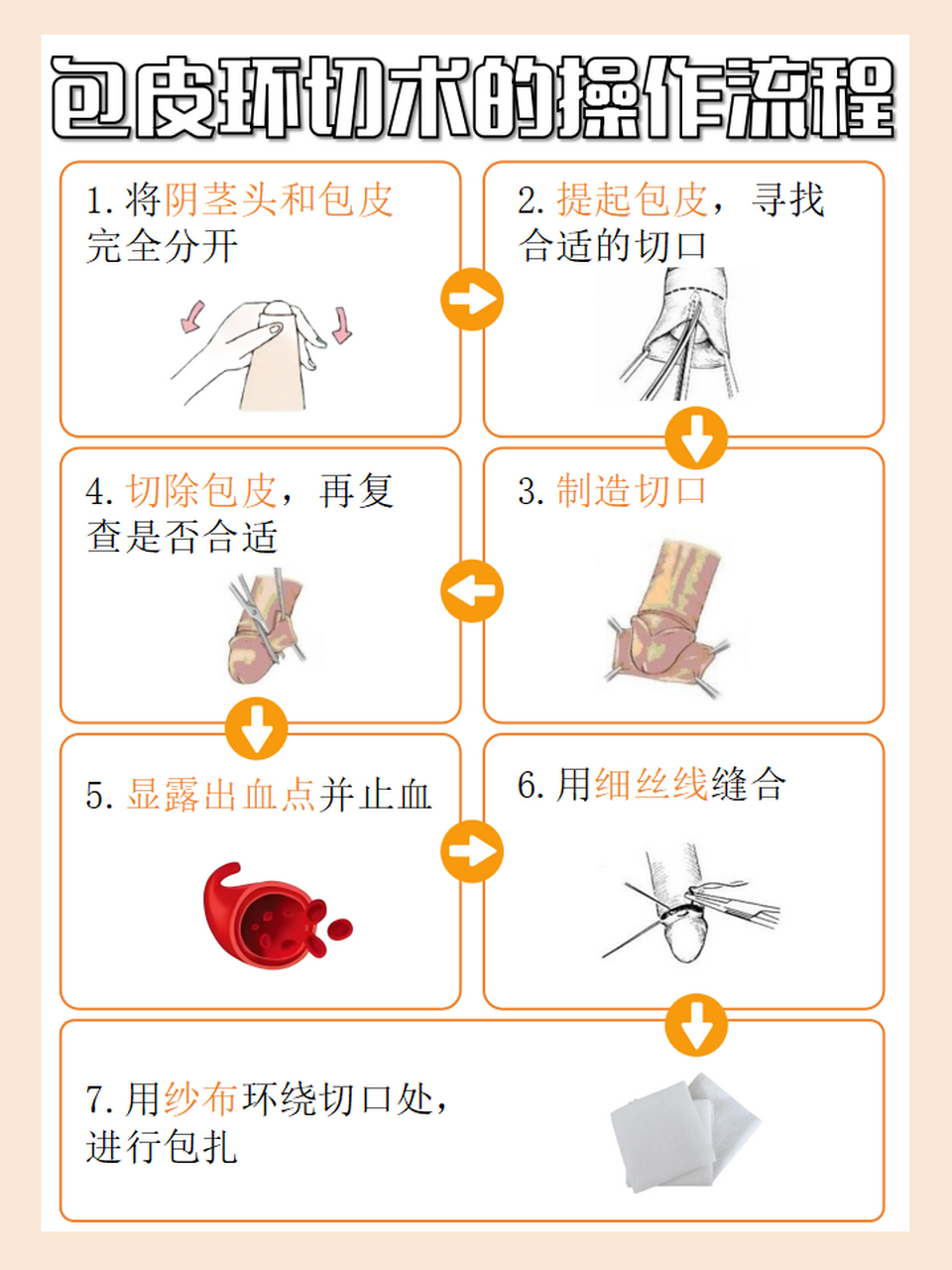 割完包茎恢复完整图片图片