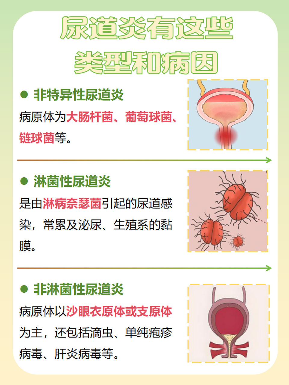 ✍通常情况下,尿道炎可以治愈,但是如果再次感染病原体,就容易复发