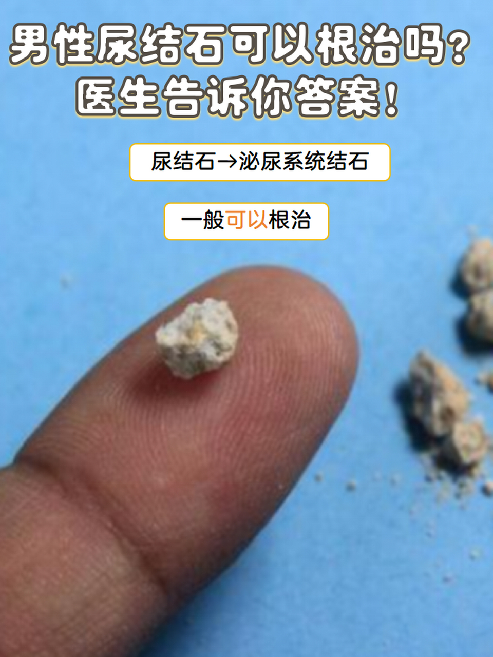 尿结石严重吗图片