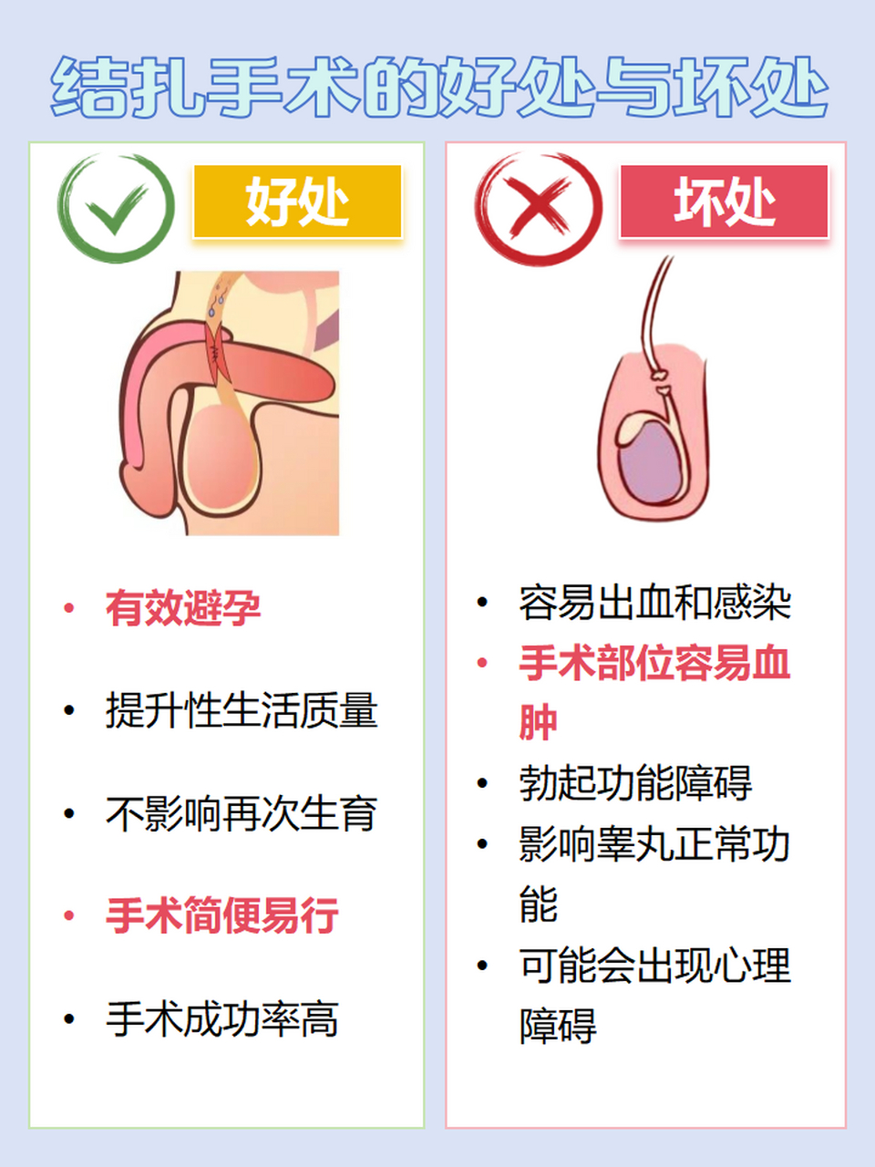 输精管结扎术新方法图片