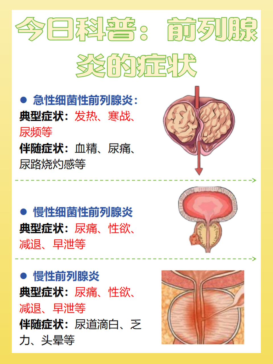 前列腺炎症状图片大全图片