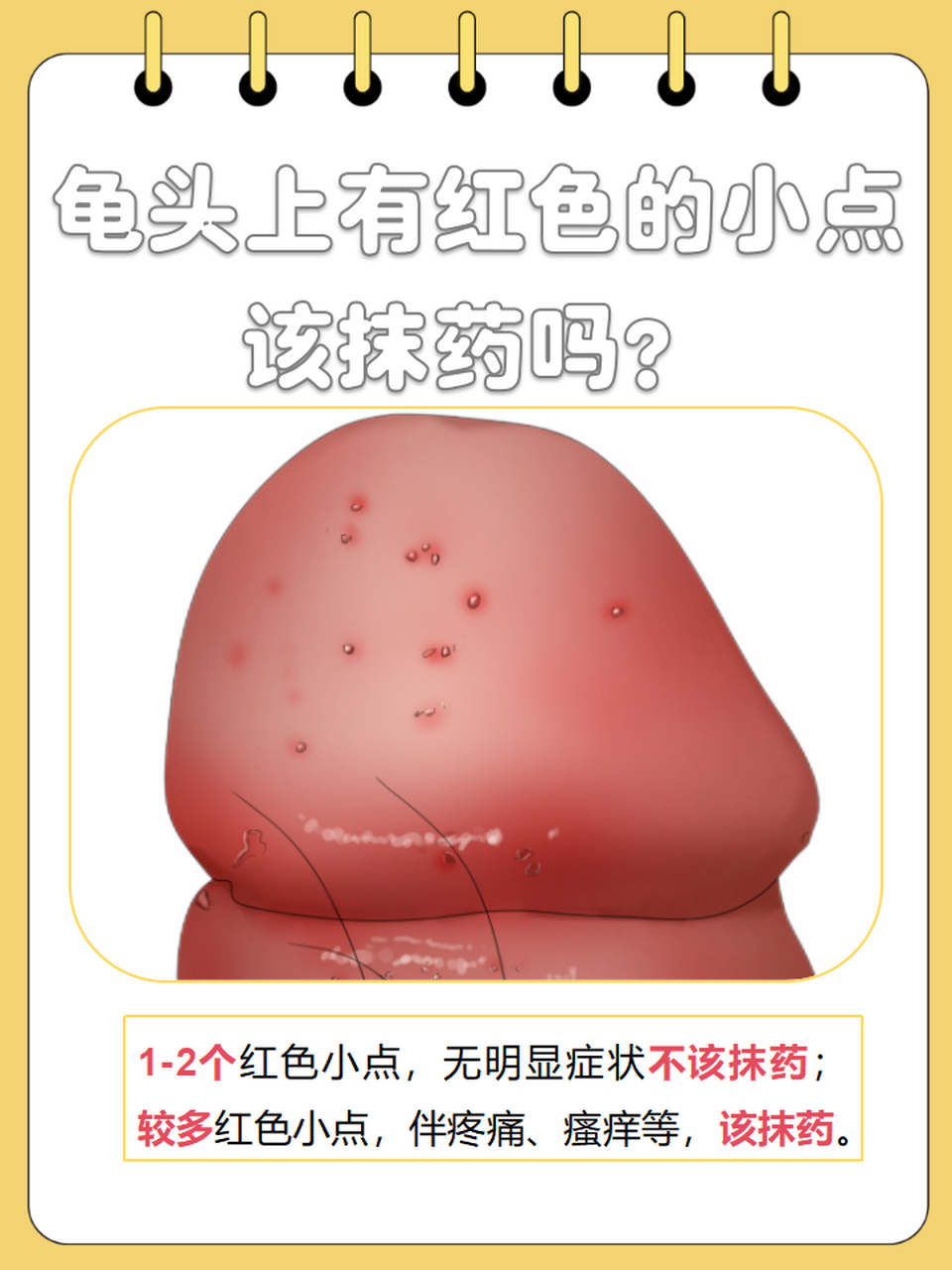 龟头上有红色的小点该抹药吗?