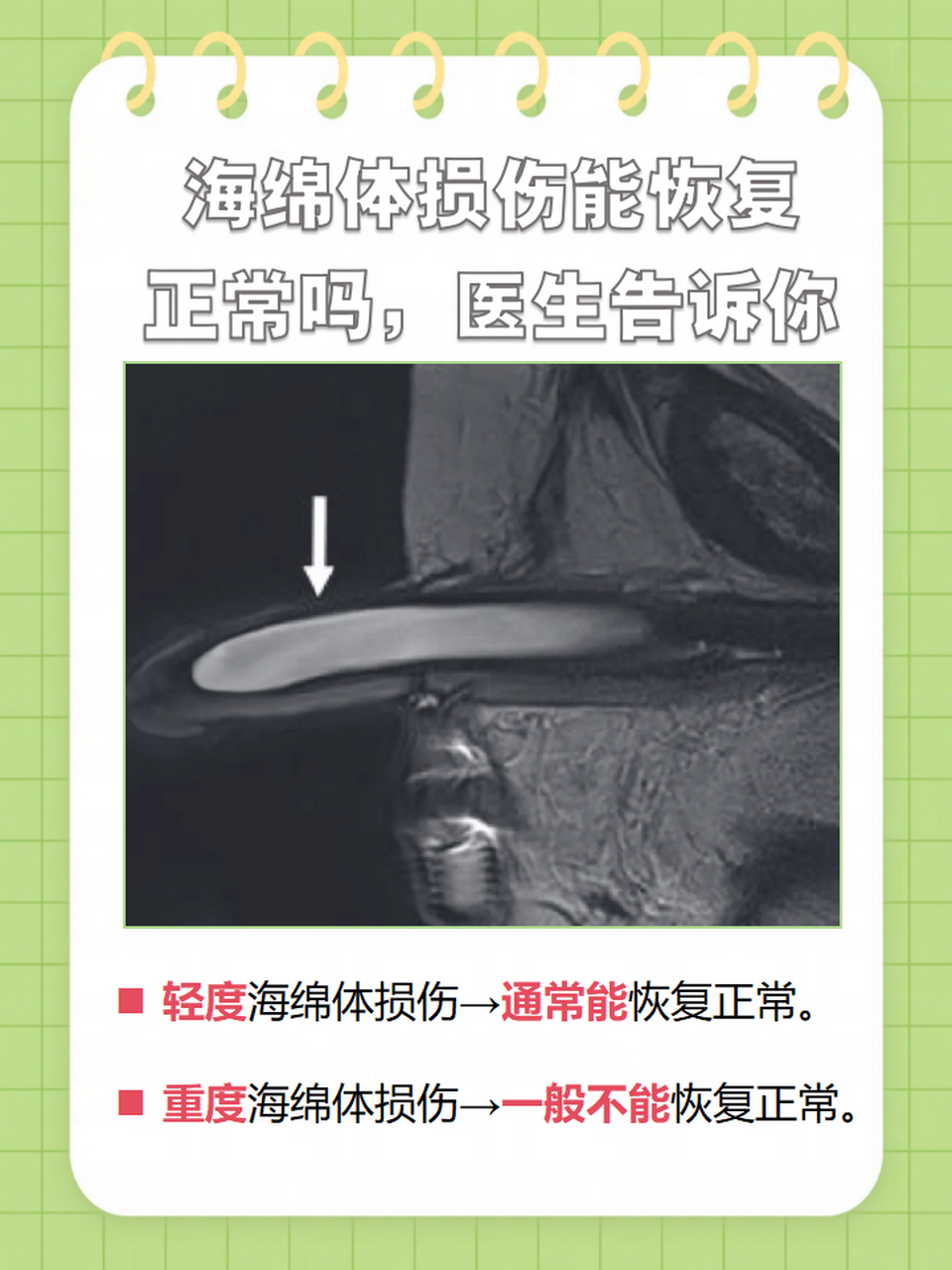 海绵体是一种勃起组织,同时也是阴茎的重要组成部分,海绵体如果出现