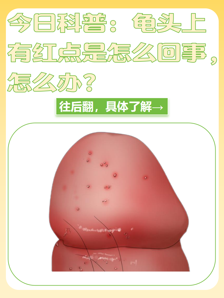 龟头上有红点是怎么回事,该怎么治疗呢?