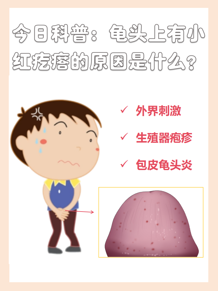 龟头上长红点小点,可能是感染或刺激引起