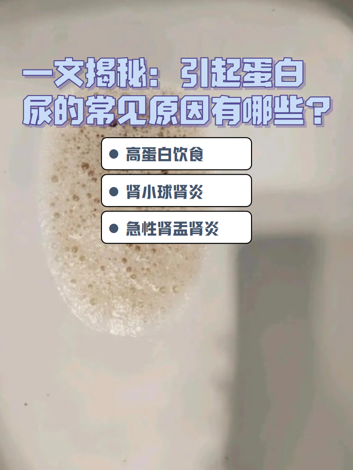 一文揭秘:引起蛋白尿的常见原因有哪些?