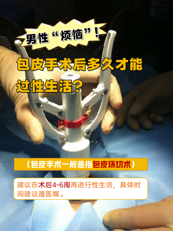 男生为什么要做割包皮手术为什么在线 男生为什么要做割包皮手术为什么在线