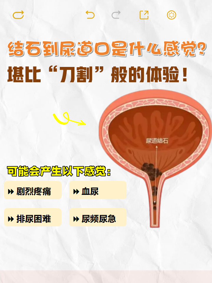 输尿管结石疼是什么原因为什么在线