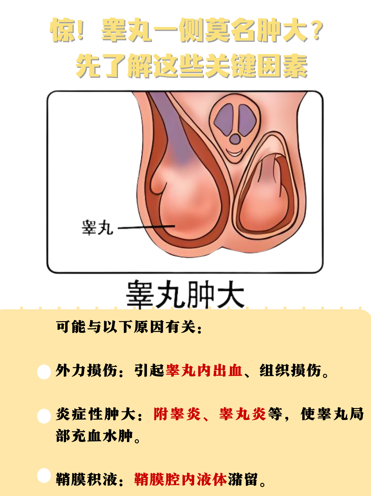 睾丸一侧莫名肿大?