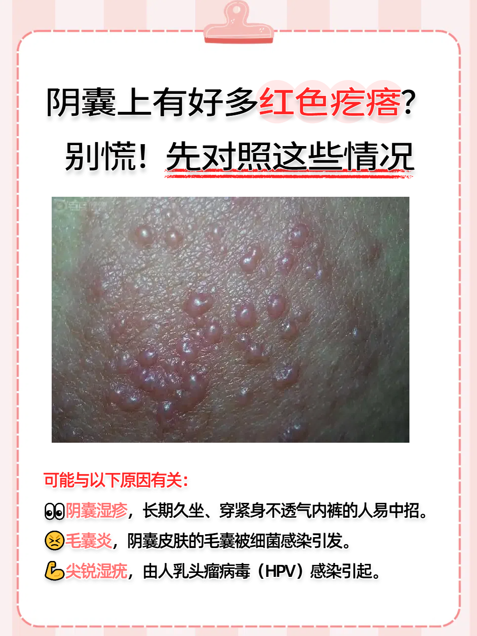 生活里,有些男性洗澡或者换衣服时,突然发现阴囊上冒