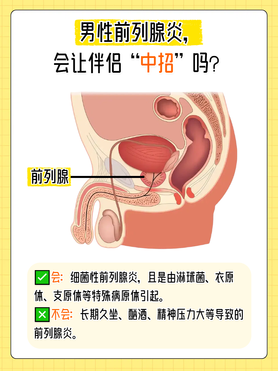 男人为什么会得前列腺炎 男人为什么会得前列腺炎