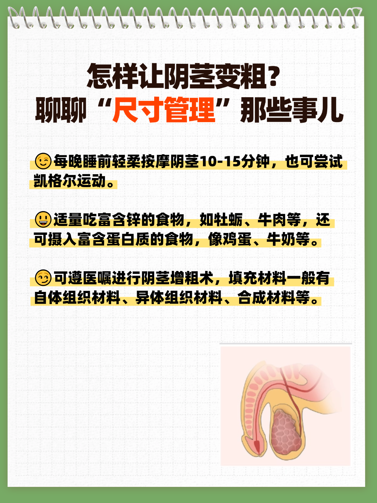 聊聊"尺寸管理"那些事儿