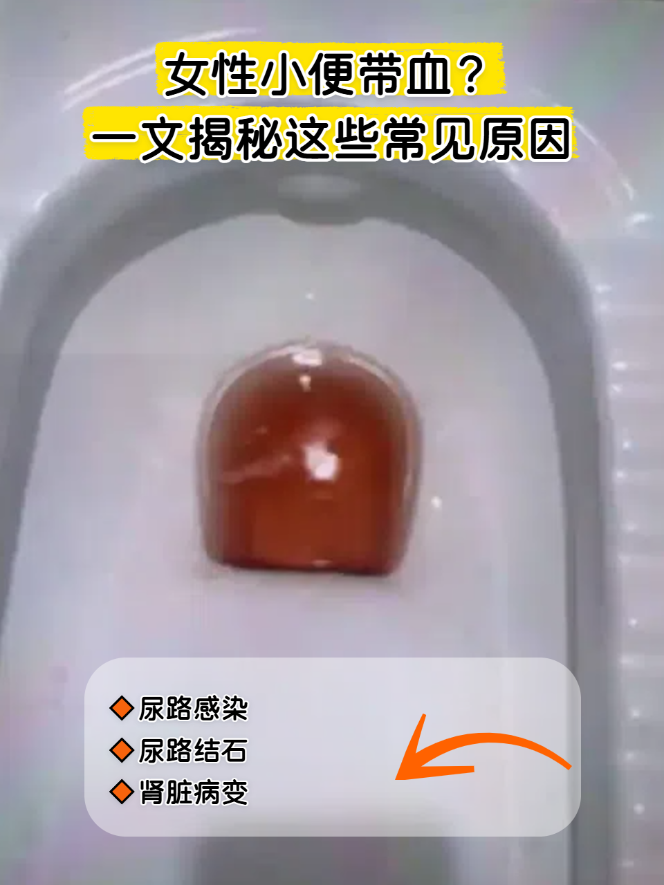 为什么拉尿会拉出血