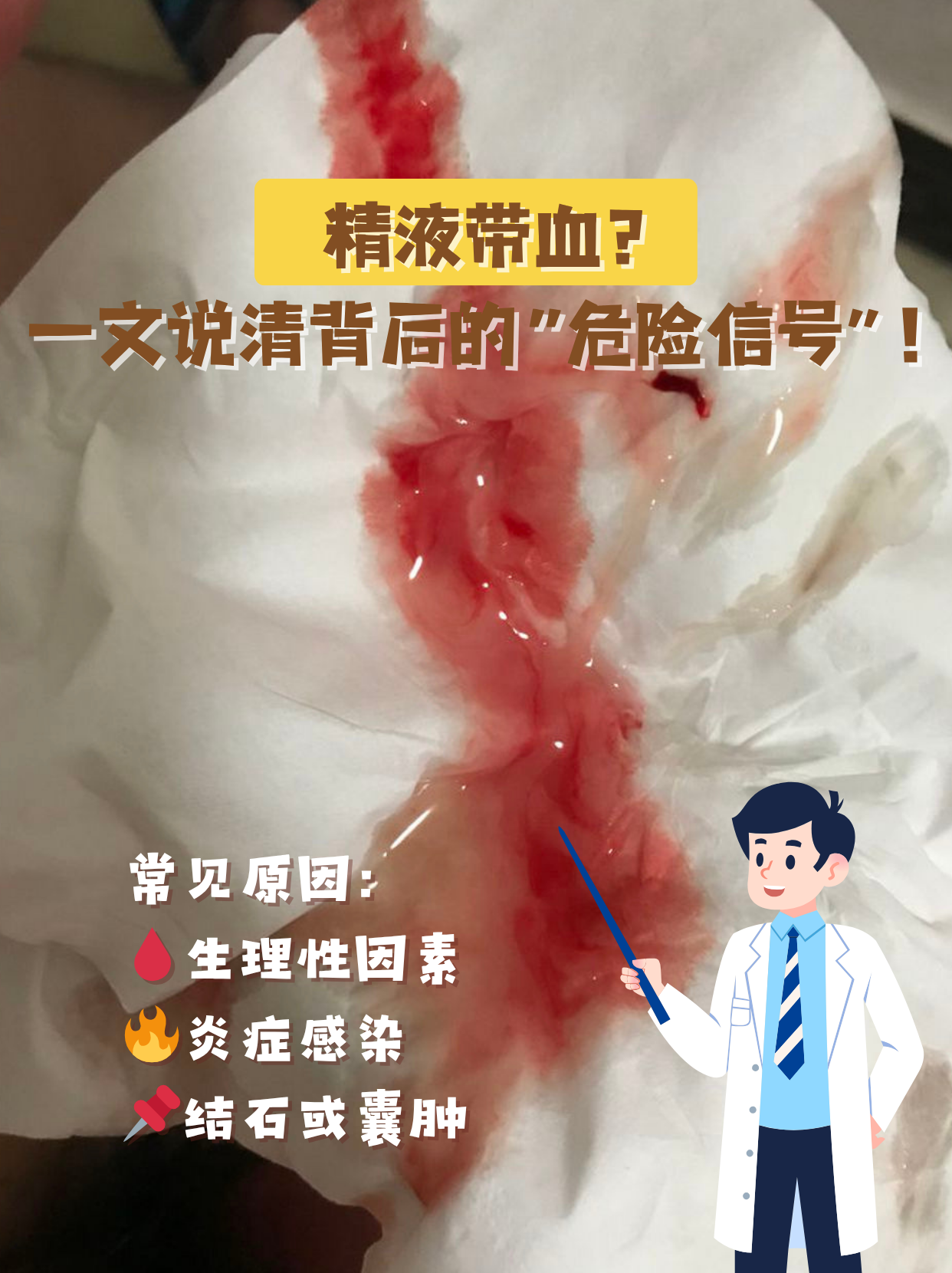 这种医学上称为"血精"的现象,到底是什么原因导致的?