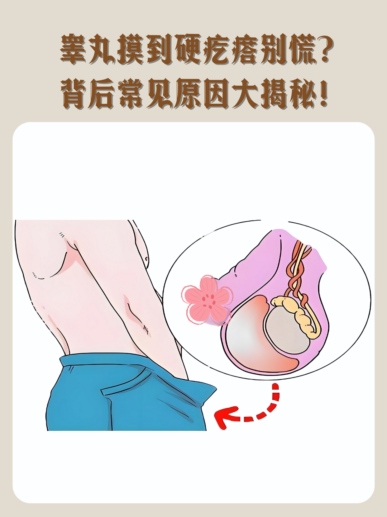 洗澡时突然摸到睾丸一侧有硬疙瘩,不少人瞬间紧张:是正常结构,还是