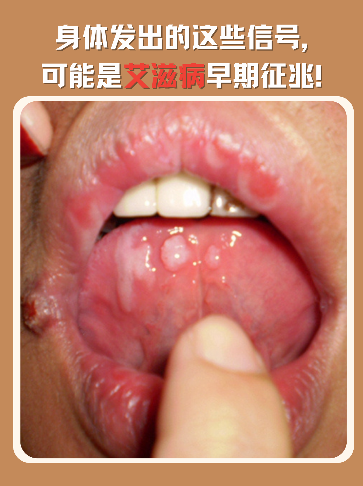  最近病毒症状早期表现是什么(最近出现的病毒)