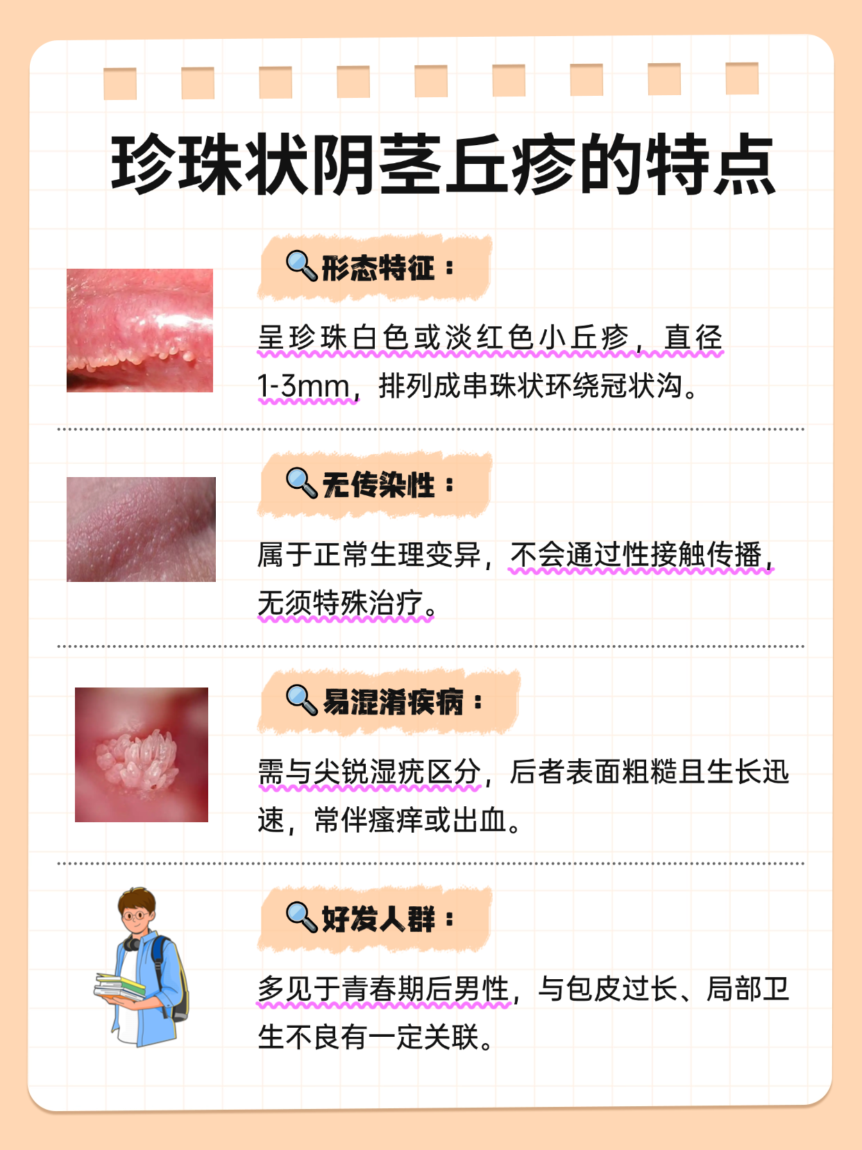 男性珍珠状阴茎丘疹的日常护理