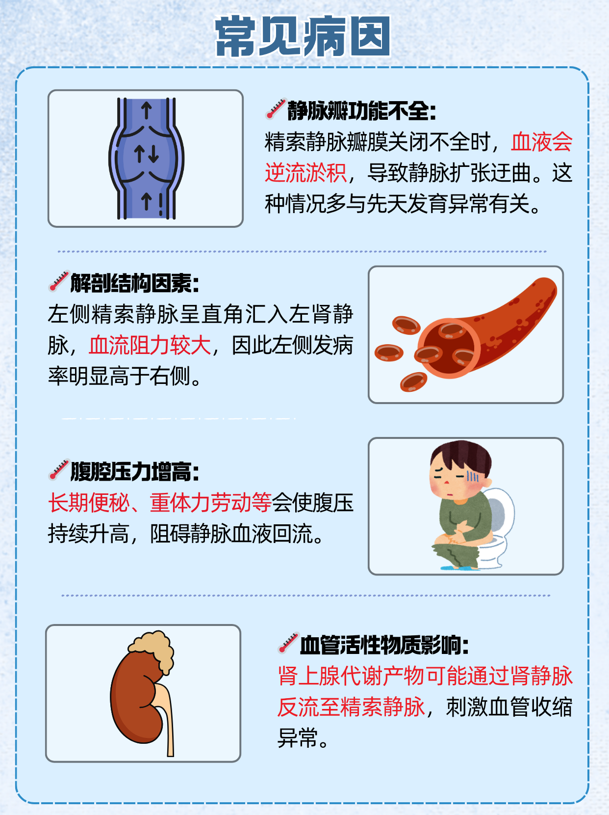 精索静脉曲张的病因都是什么