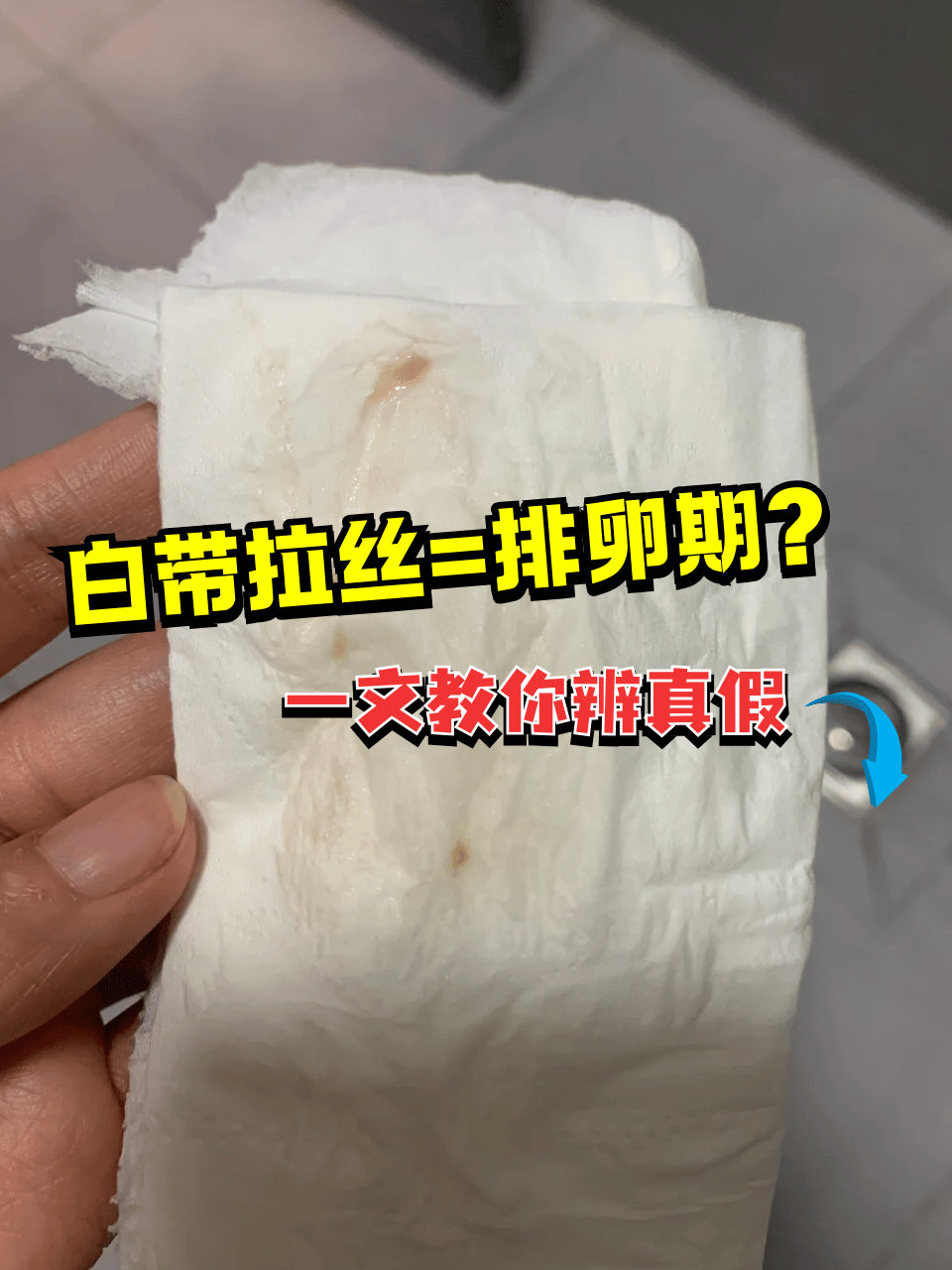 不少人会发现白带偶尔出现拉丝的情况,这是不是意味着排卵期到了呢?