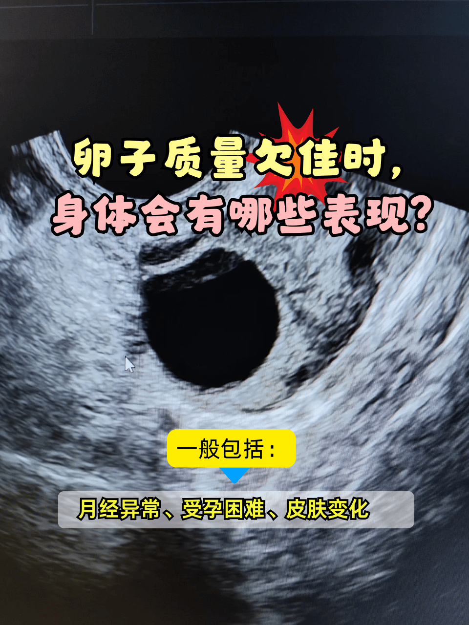 受精卵初期症状(受精卵形成初期的人体反应)