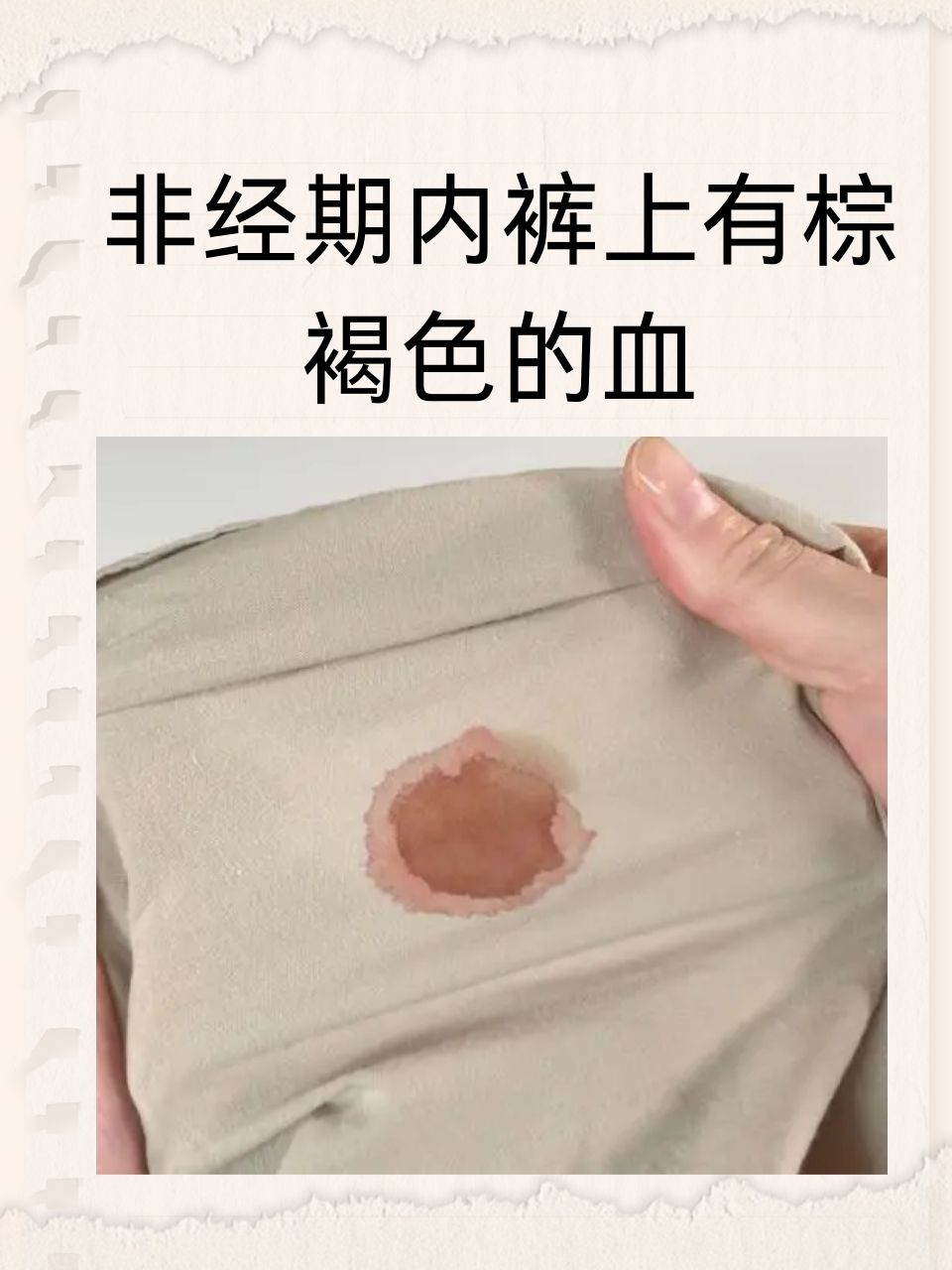 非经期内裤上有棕褐色的血是怎么回事