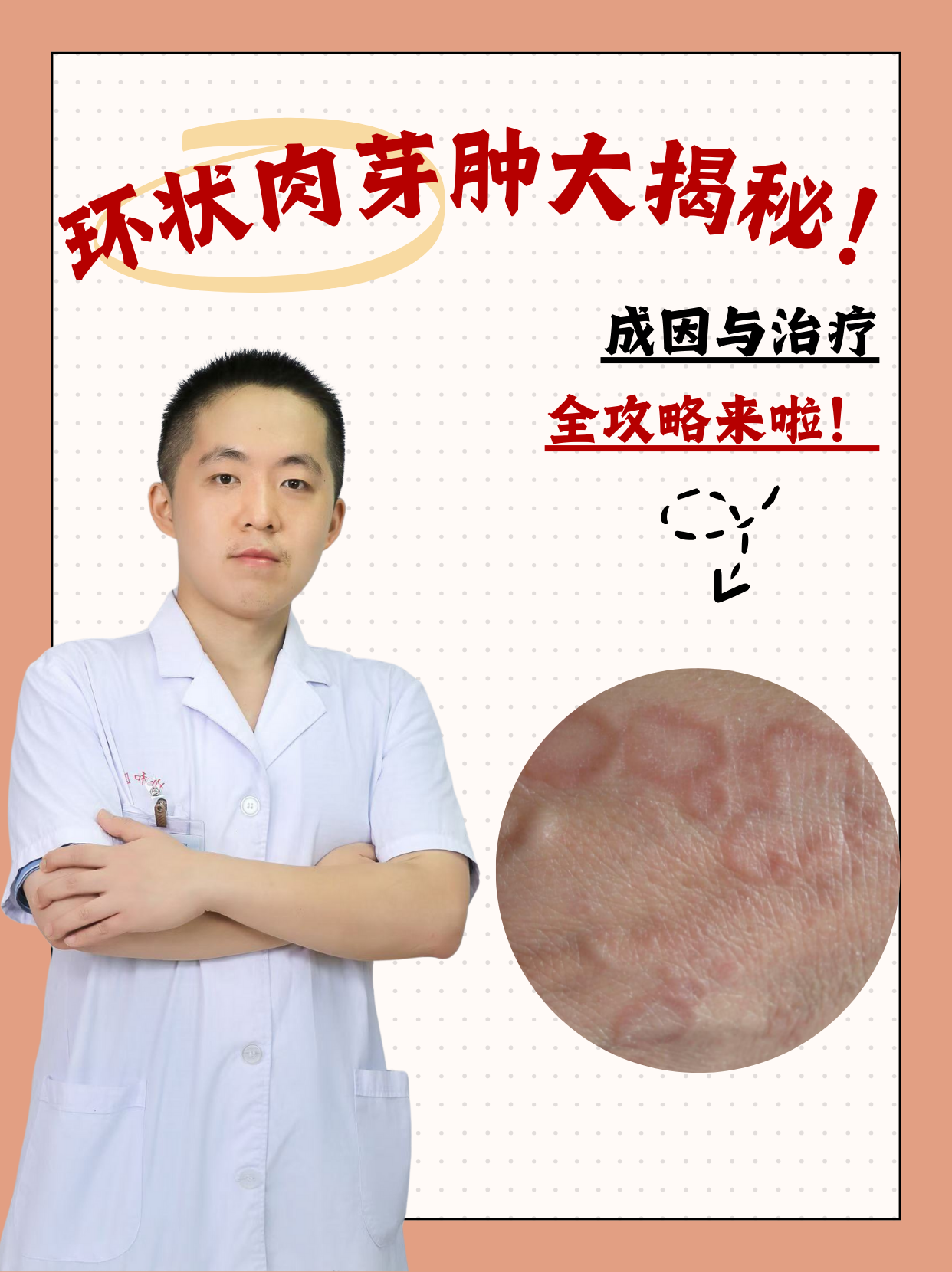 成因与治疗全攻略来啦!