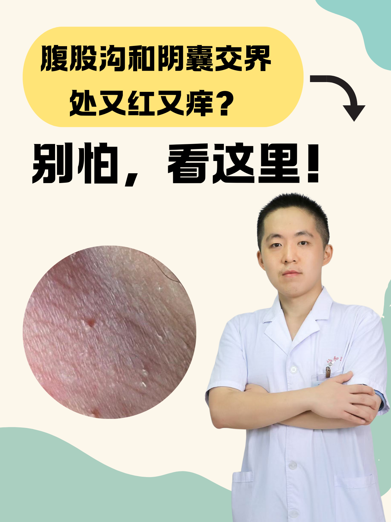 腹股沟和阴囊交界处红痒,可能是皮肤摩擦与潮湿,真菌感染