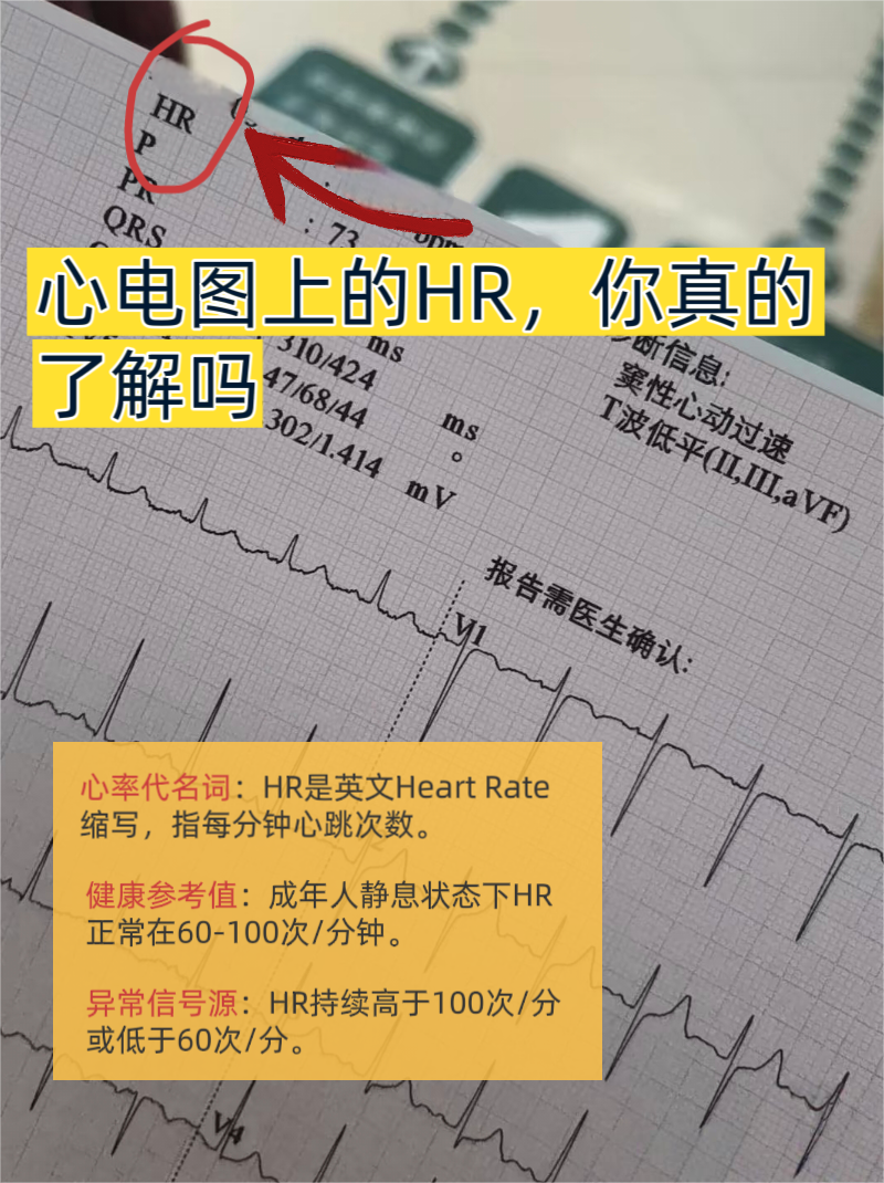 它究竟代表什么?日常认知里又存在哪些误区?