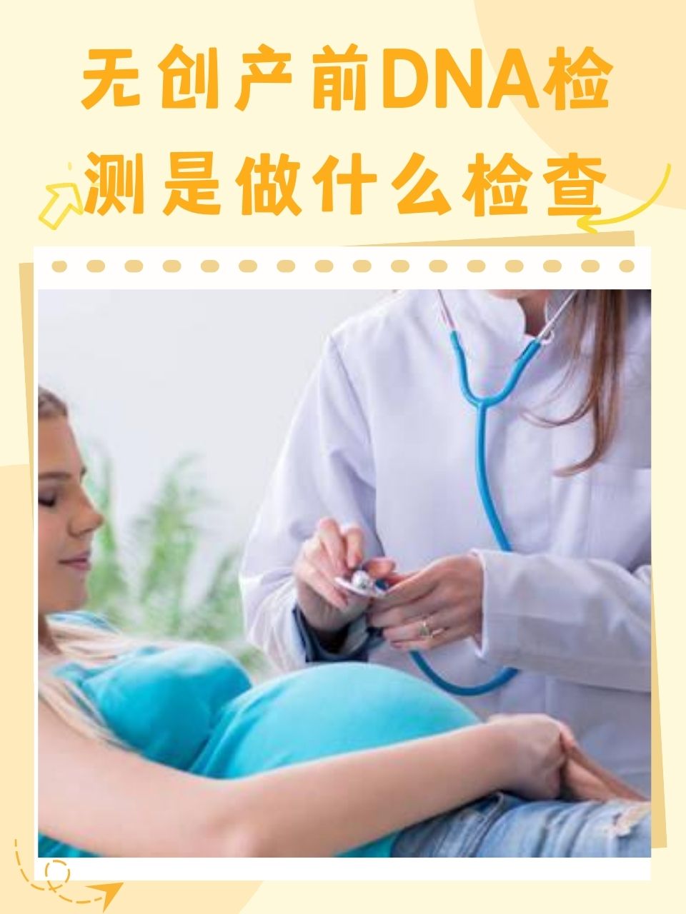 无创产前dna检测是什么检查
