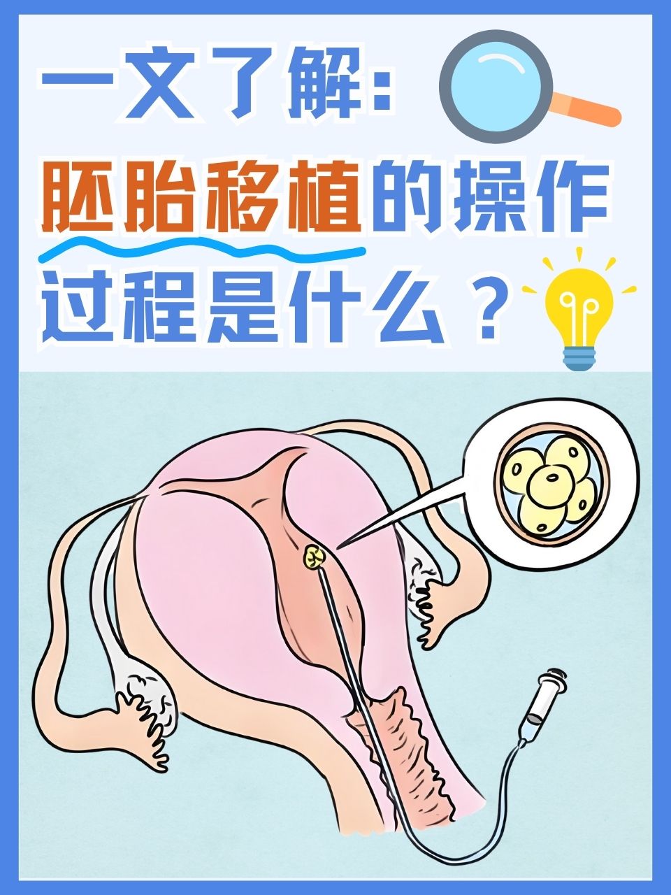 胚胎移植需要多少钱_胚胎移植需要多少钱一次  第2张