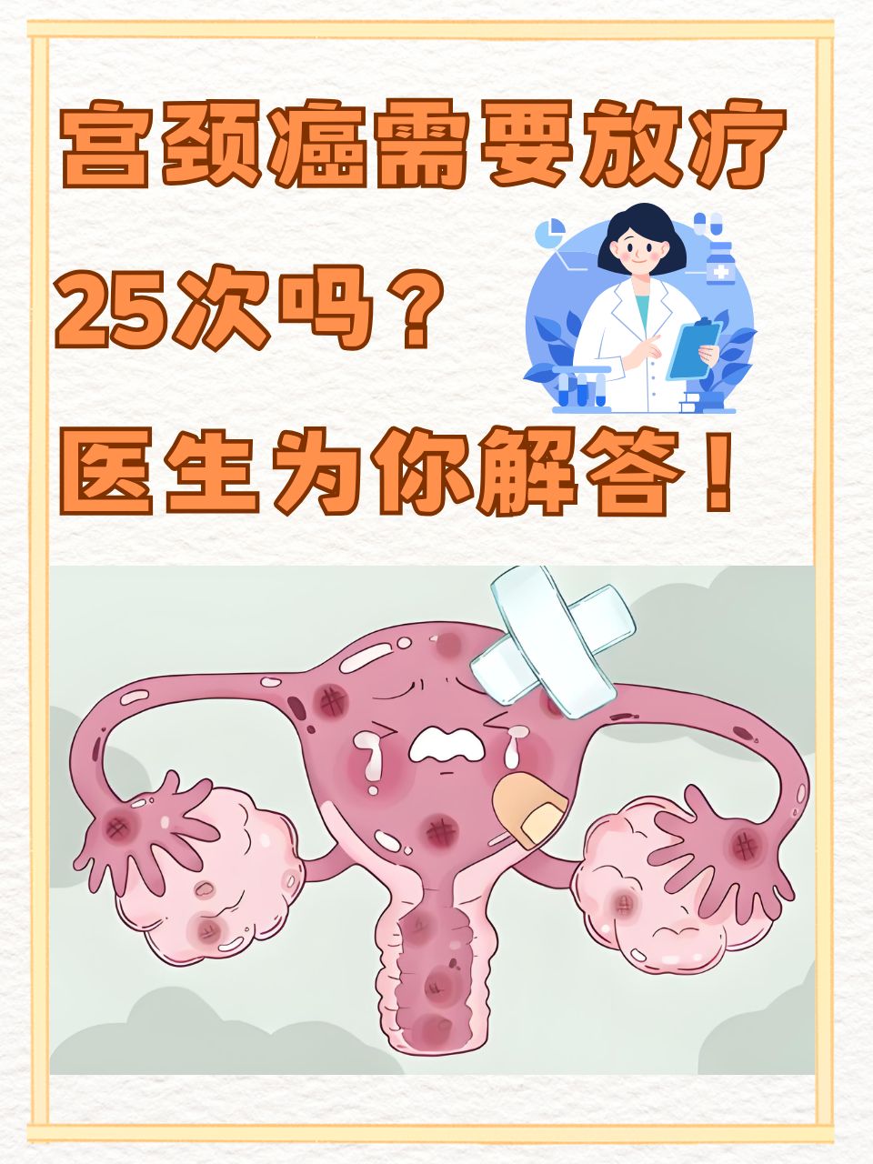 宫颈癌放疗