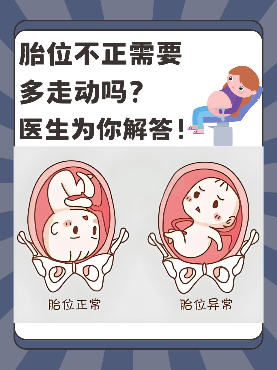 周绕脖子一圈胎位不正纠正图 姿势视频胎方位异常是什么原因胎儿横位