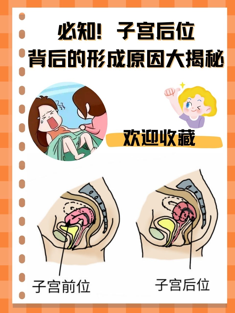 子宫后位背后的形成原因大揭秘