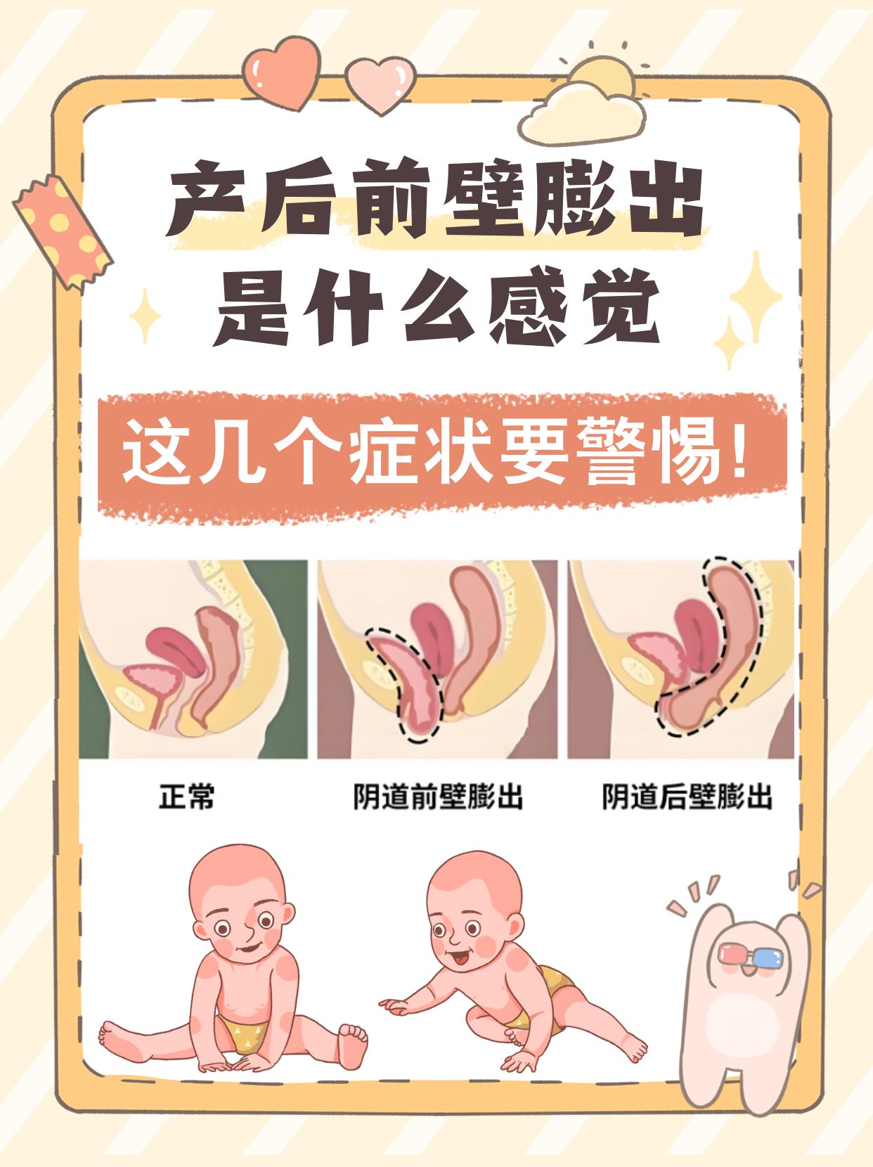 帮你了解和产后前壁膨前壁膨出的清晰图片前壁膨出的清晰图阴壁膨出