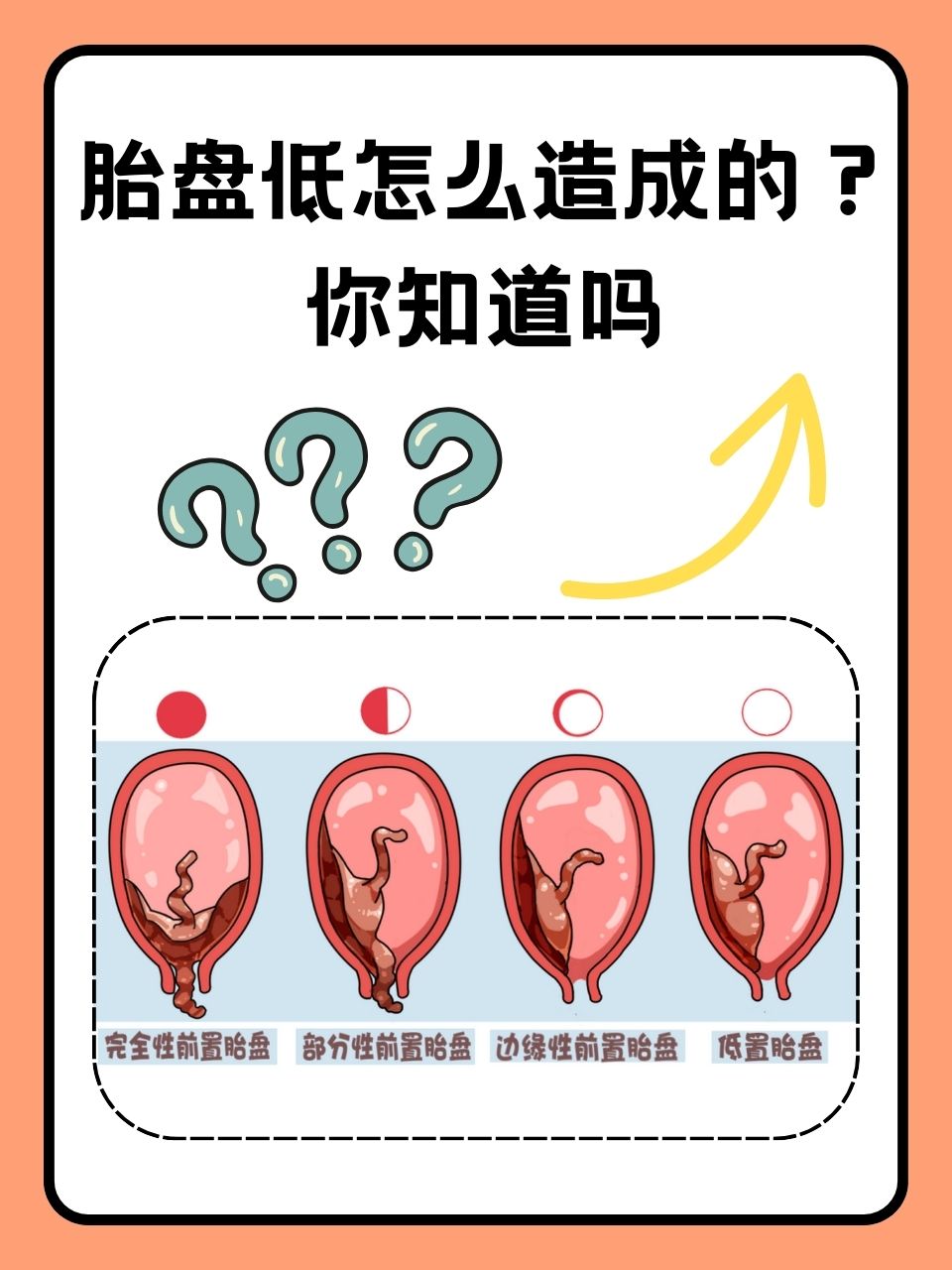 然而,有时候,这个过程中可能会出现一些小插曲,比如胎盘低置