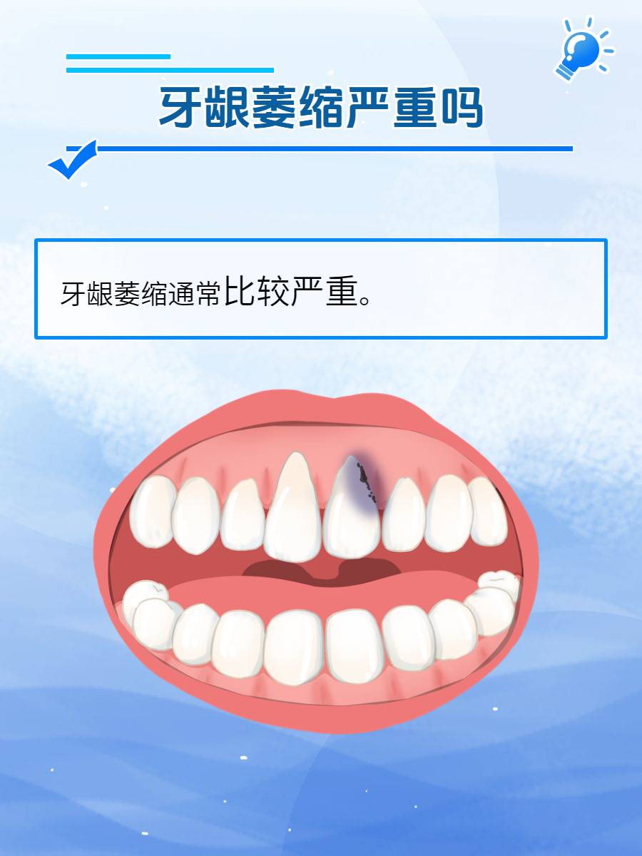 为什么会牙龈萎缩的原因为什么在线 为什么会牙龈萎缩的原因为什么在线
