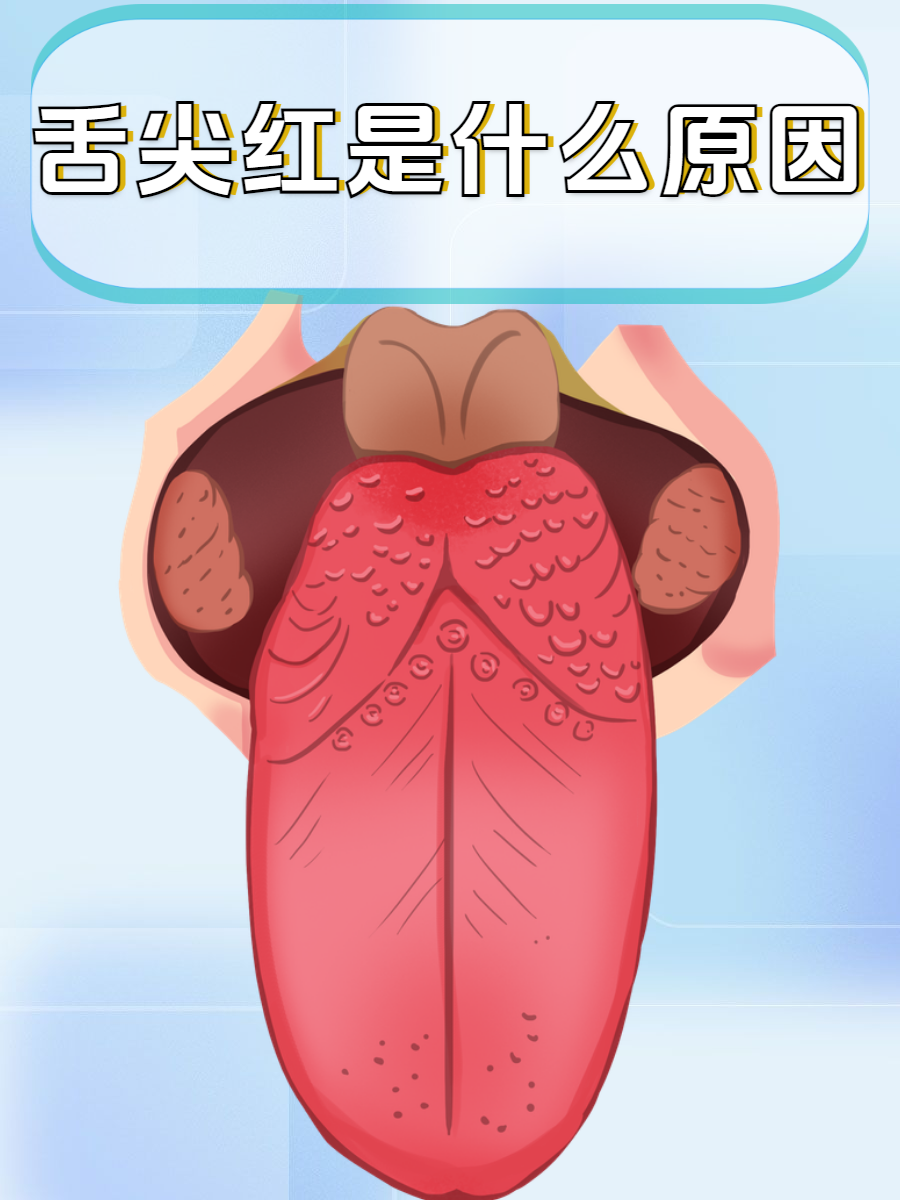 一般来说,舌尖发红可能的原因有很多