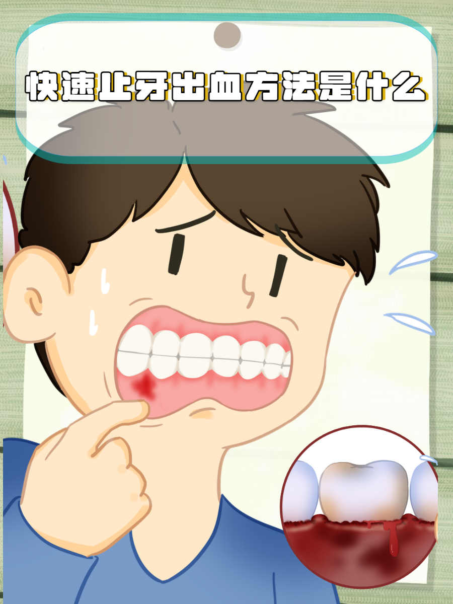 牙齿为什么出血 牙齿为什么出血
