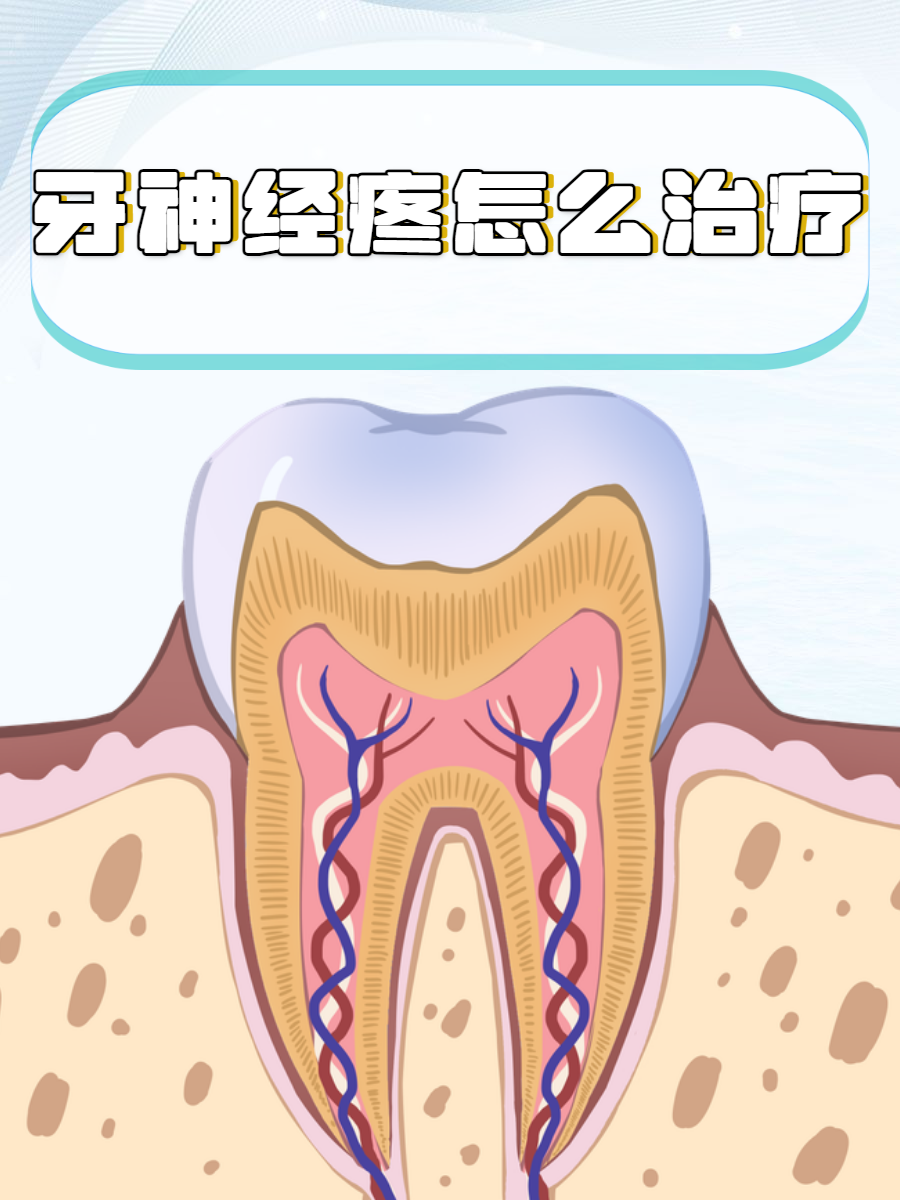 杀了神经的牙为什么还疼