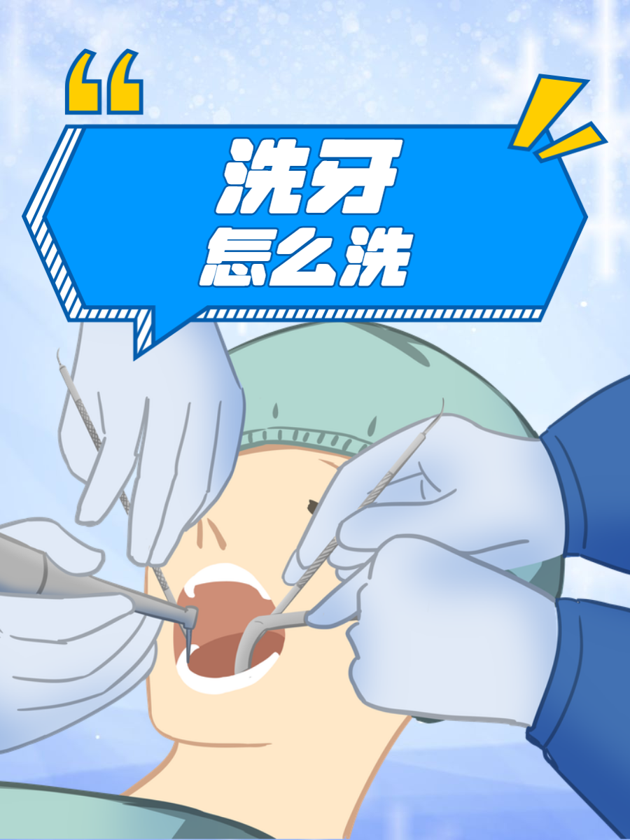 洗牙宣传图片定期洗牙洗牙卡通图片洗牙的图片洗牙手机图片大全洁牙