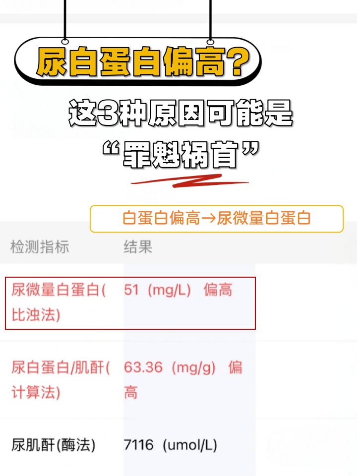 尿微量白蛋白肌酐比值对照表尿蛋白高是怎么回事尿微量白蛋白高是怎么