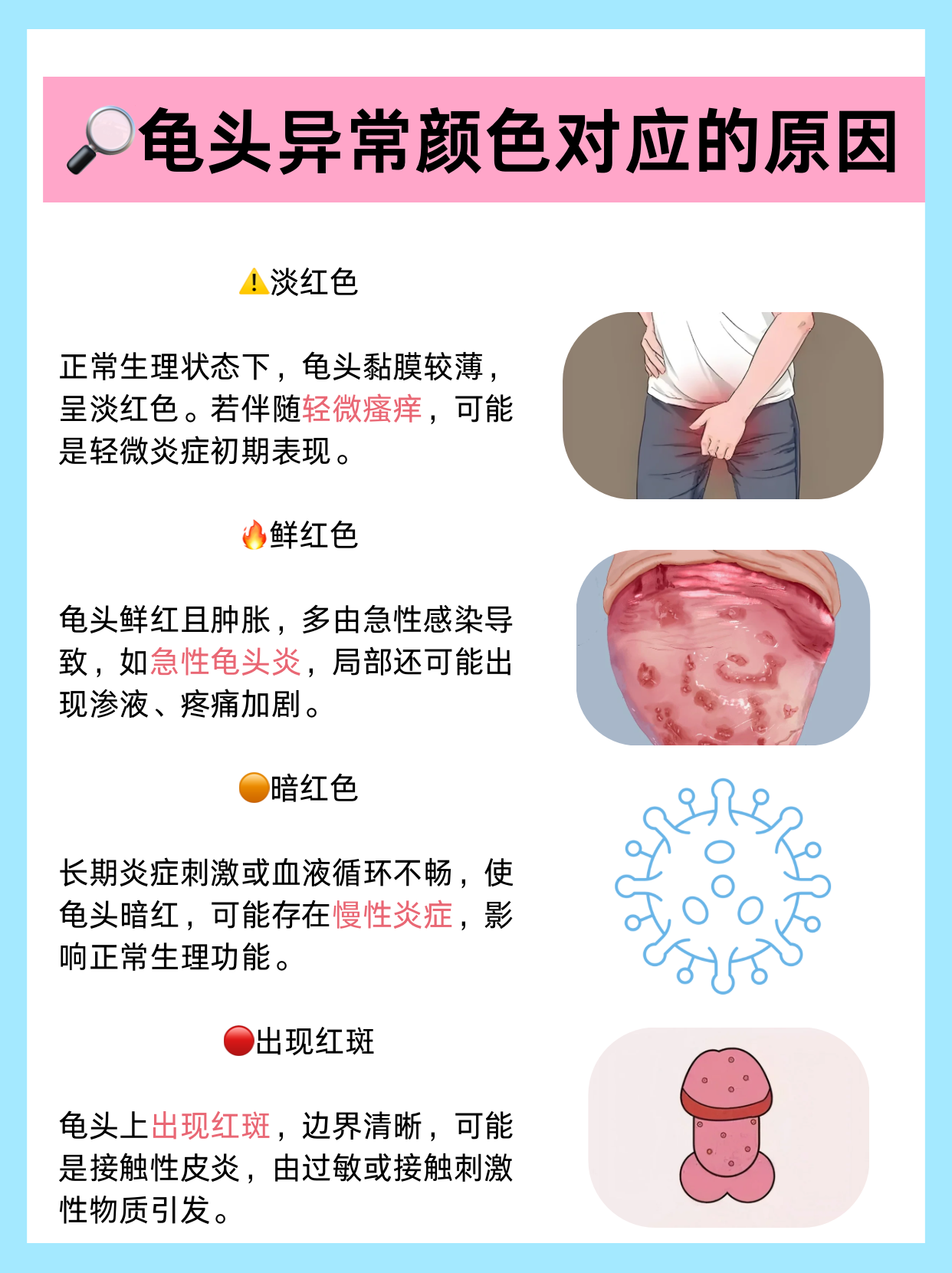 为什么每次和老公同房后下面痒 为什么每次和老公同房后下面痒